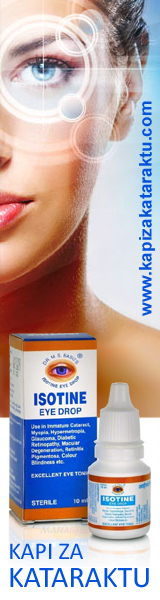 Kapi za kataraktu